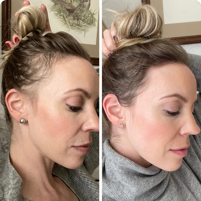 Haluna 2.0™ Revival Scalp Infusion Therapy Comb