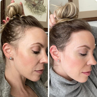 Haluna 2.0™ Revival Scalp Infusion Therapy Comb