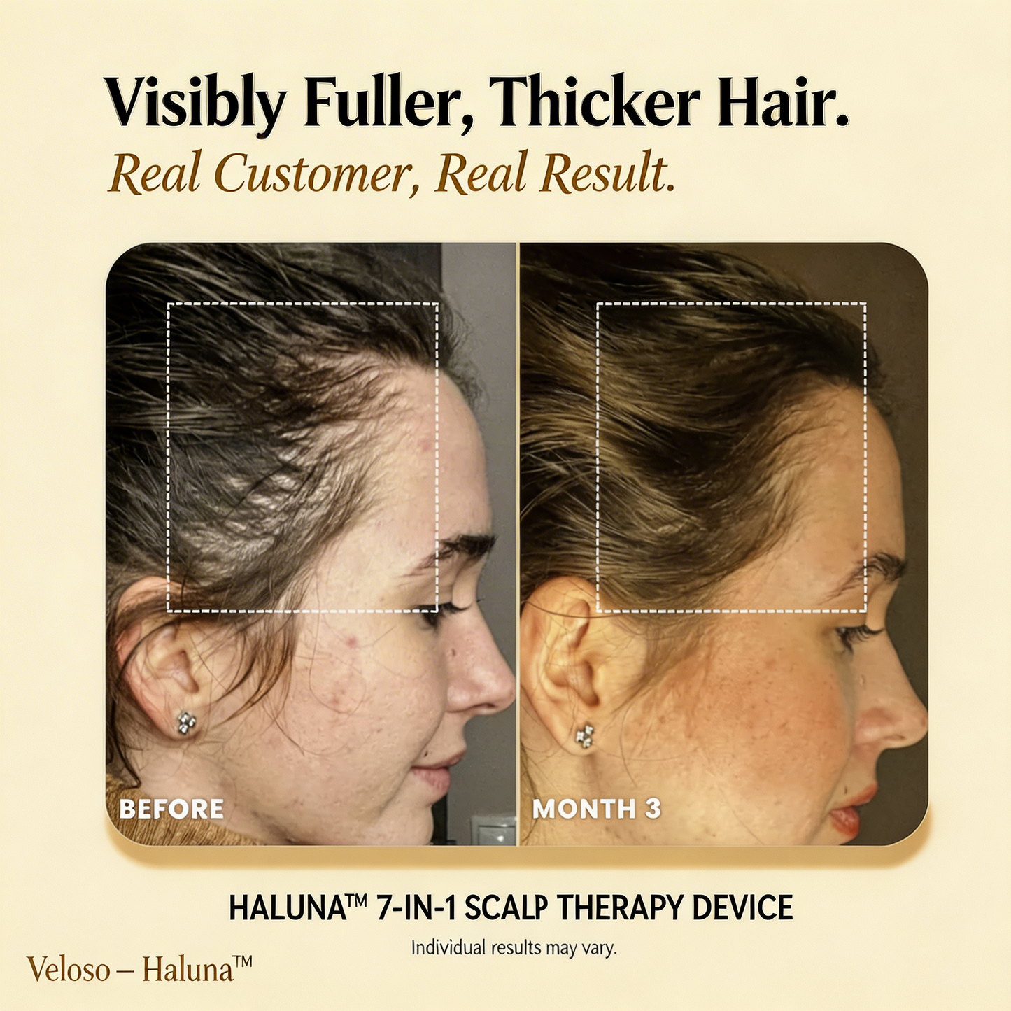 Haluna 2.0™ Revival Scalp Infusion Therapy Comb