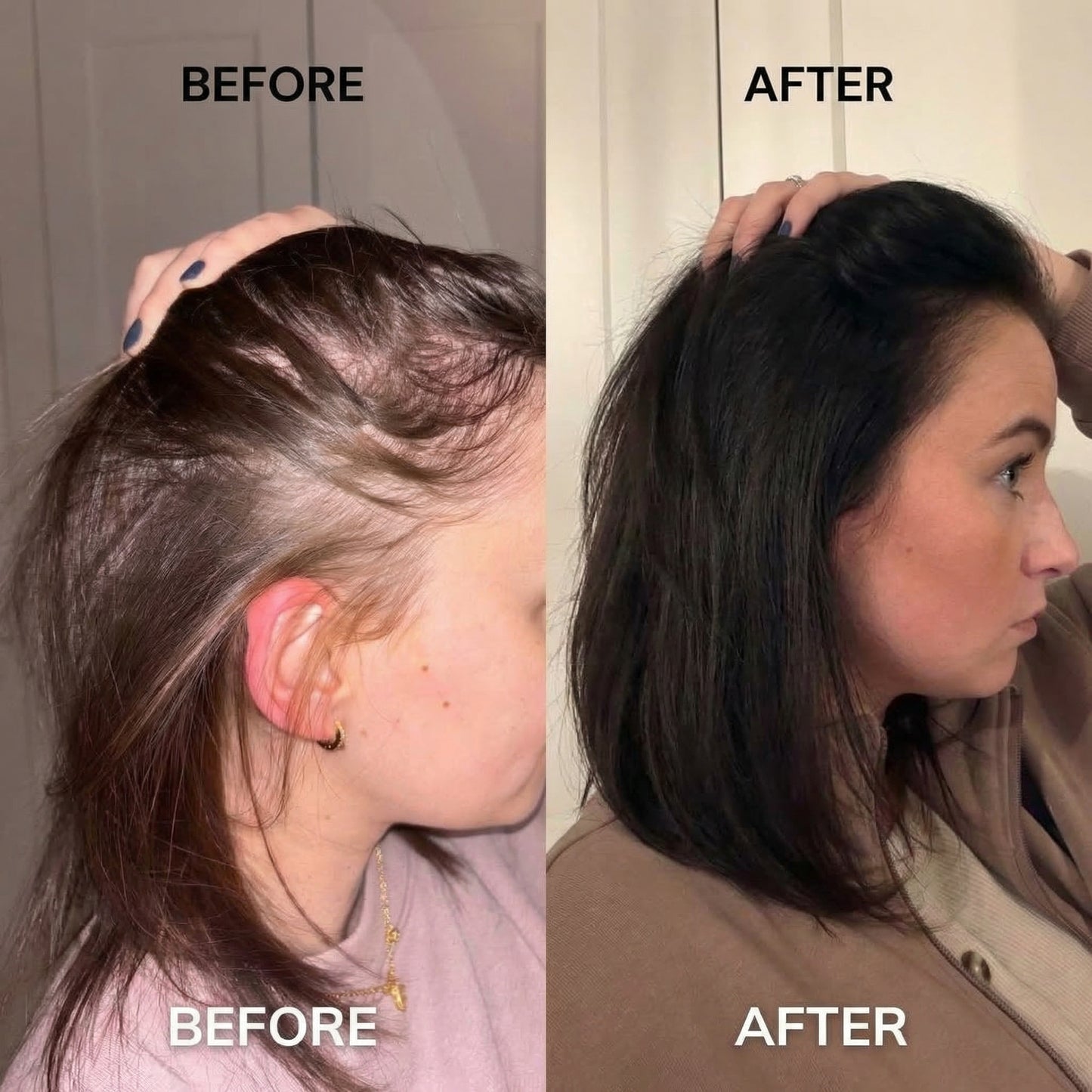 Haluna 2.0™ Revival Scalp Infusion Therapy Comb